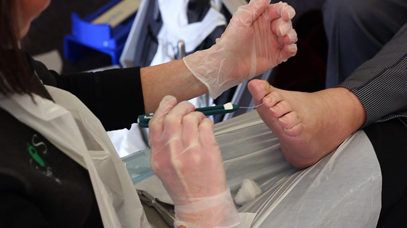 Jak zadbać o zdrowy i atrakcyjny wygląd stóp?