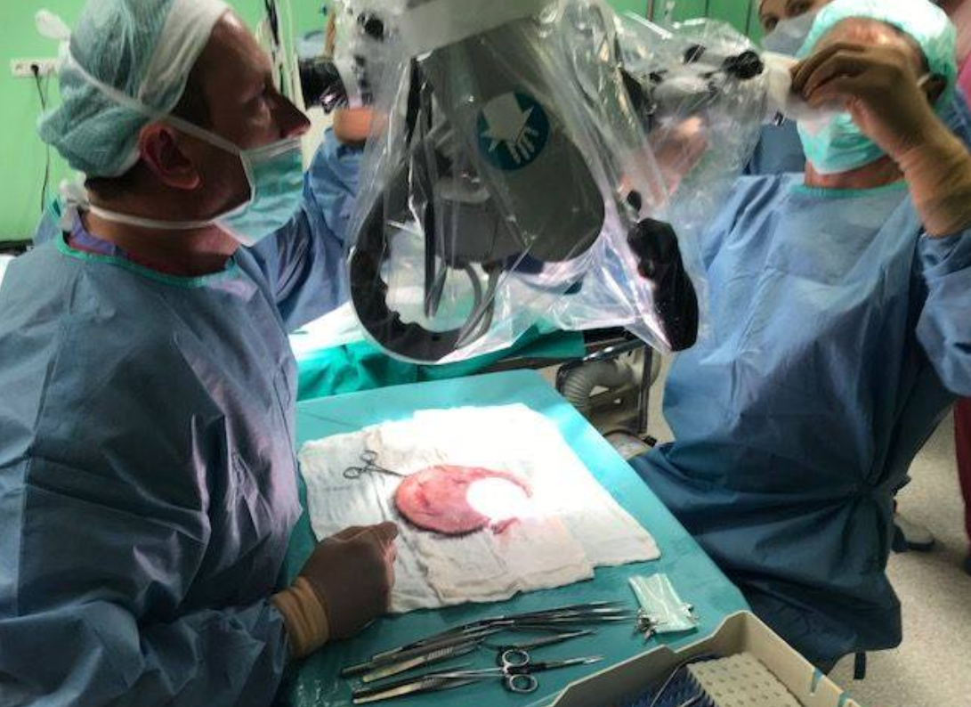 Zespół gliwickich chirurgów po kolejnej udanej replantacji