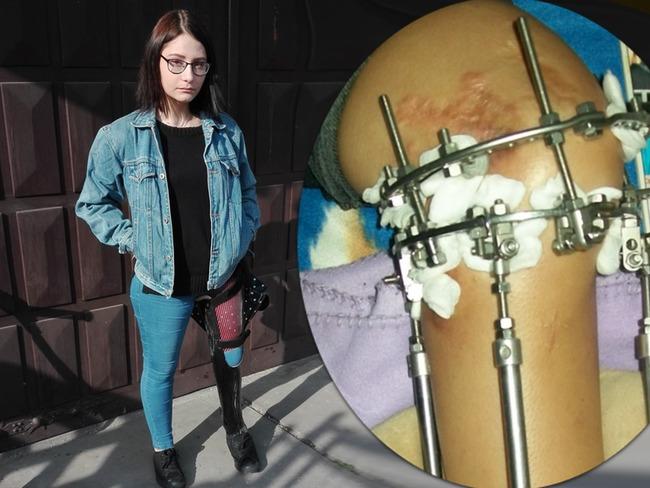 Zaśpiewają dla Wiktorii. Charytatywna zbiórka już w sobotę