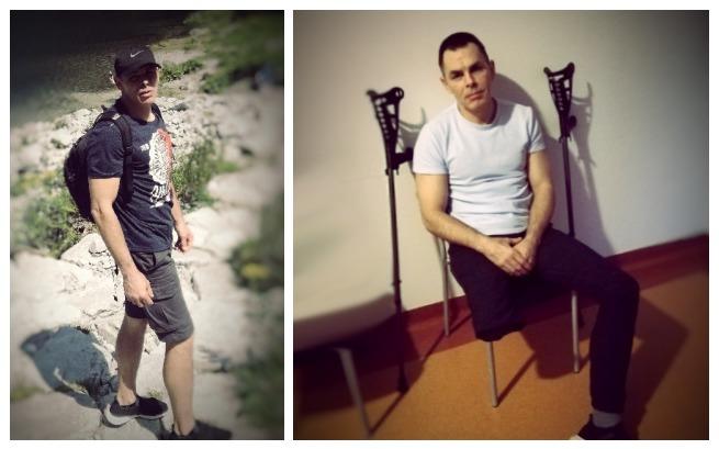 Chorzów: Górnik po wypadku na kopalni potrzebuje protezy. Trwa zbiórka pieniędzy!