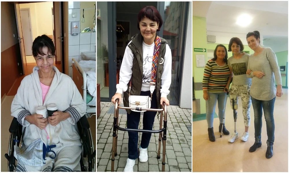 Podwoili kwotę zbiórki na zakup protezy dla pani Iwony!