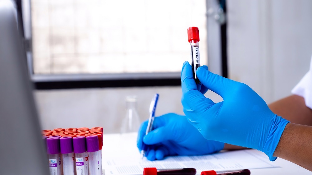 Czy miałeś kontakt z koronawirusem? Możesz wykonać test serologiczny!