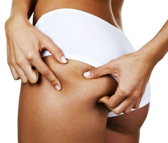 Balsam ujędrniający - jaki wybrać? Poznaj Vialise Lifting Effects