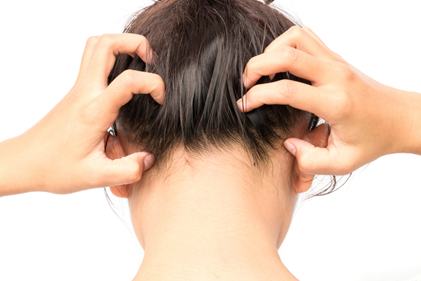 Jak rozpoznać łupież pstry?