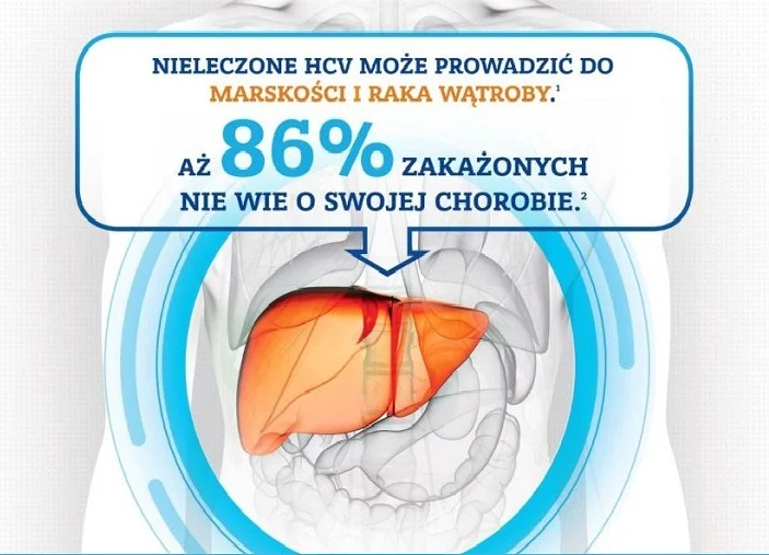HCV – tego wirusa może mieć każdy! Zrób bezpłatne badania