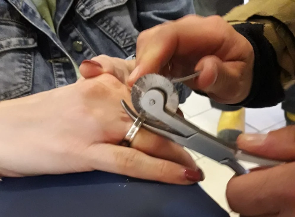 Strażacy musieli rozciąć kobiecie obrączkę