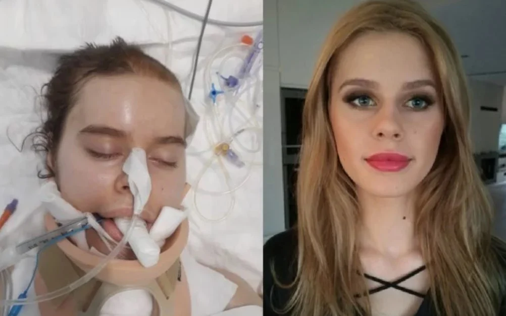 22-letnia mikołowianka mierzy się z guzem mózgu. Potrzebuje masę pieniędzy na leczenie