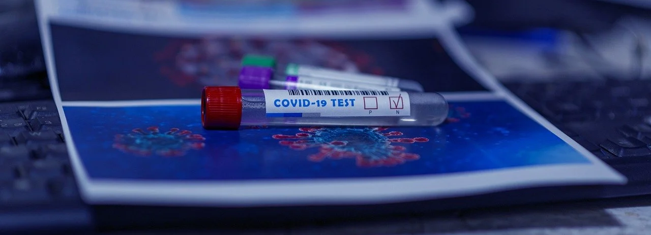 Zdecydowanie za wcześnie rezygnujemy z powszechnego testowania i izolowania pacjentów