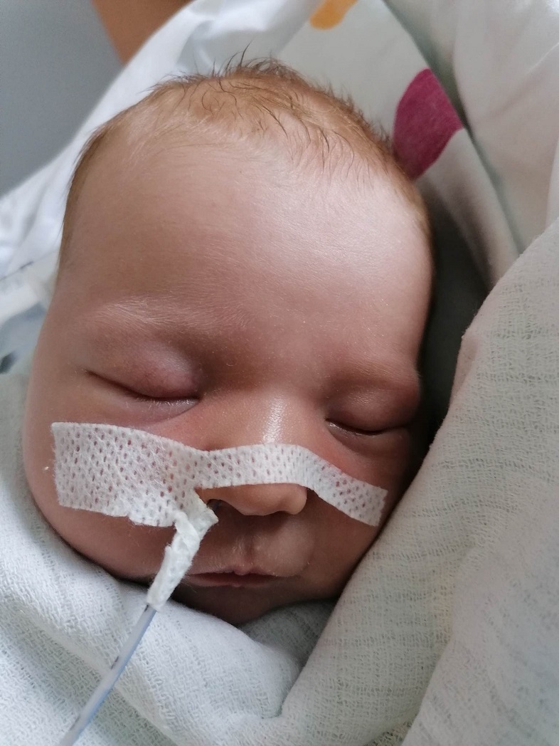 Lenka urodziła się z obustronnym rozszczepem podniebienia. Potrzebuje kosztownego leczenia