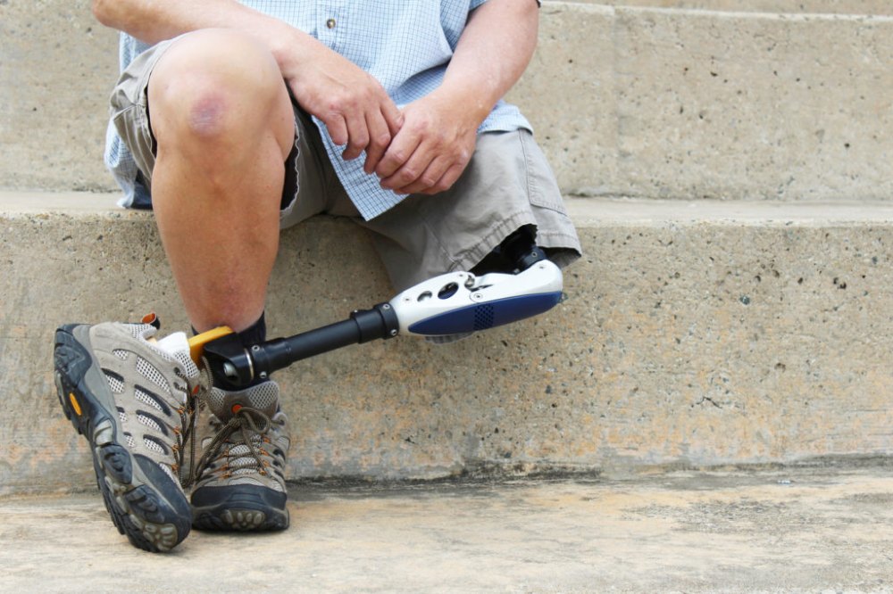 Nabór wniosków osób z niepełnosprawnościami. Program "Aktywny Samorząd" w Piekarach Śl.