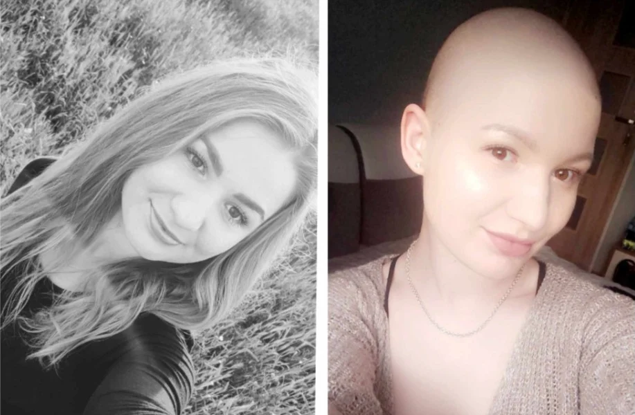 Mieszkanka Rudy Śląskiej walczy z nowotworem. Potrzebne nasze wsparcie!