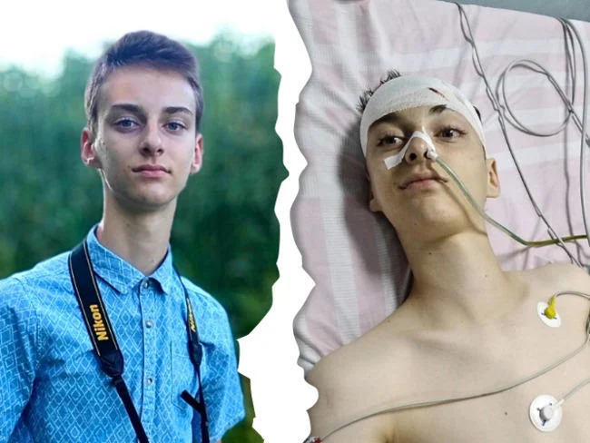 Zaczęło się od bólu nogi. Diagnoza - rak mózgu. Trwa zbiórka na rehabilitację Tymoteusza