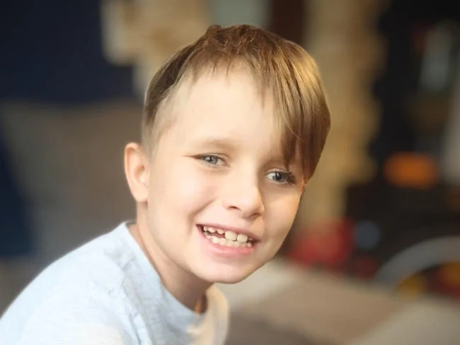 Jakub z Chorzowa musiał przejść kraniotomię. Teraz potrzebna jest operacja!