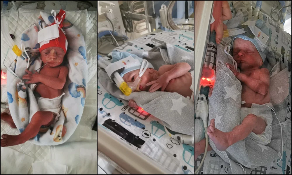 W rudzkim szpitalu na świat przyszły trojaczki!