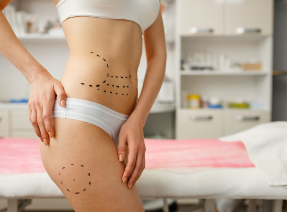 Gdzie można stosować botoks na ciele? Sprawdźmy