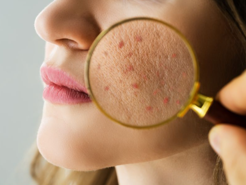 Nie lekceważmy problemów dermatologicznych. Leczmy je!