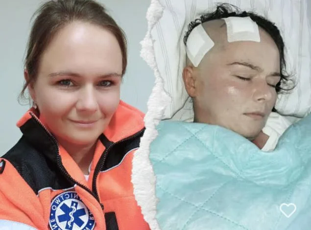 Agnieszka walczy z rzadką chorobą. Możemy ją wesprzeć w tej walce