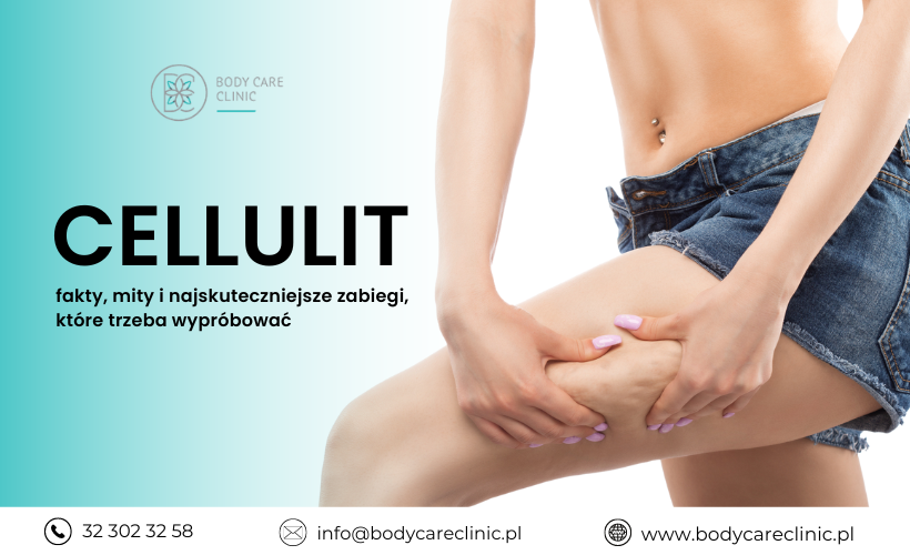 Cellulit – fakty, mity i najskuteczniejsze zabiegi, które trzeba wypróbować