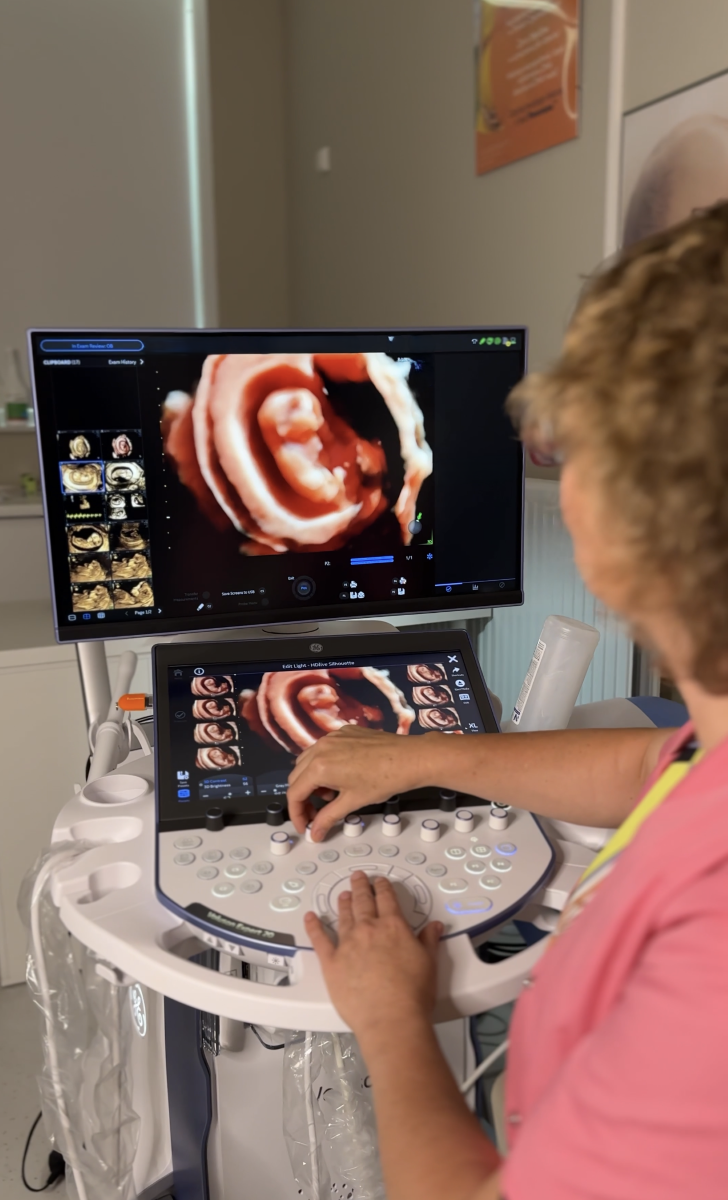 Jeden z najlepszych na świecie aparatów USG do diagnostyki prenatalnej trafił do Katowic