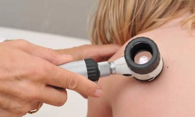 Mieszkańcy Sosnowca wykonają bezpłatne badania przesiewowe w kierunku czerniaka skóry