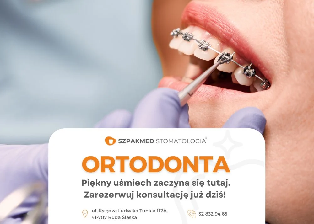 Szpakmed Stomatologia – nowoczesna opieka stomatologiczna w sercu Rudy Śląskiej.