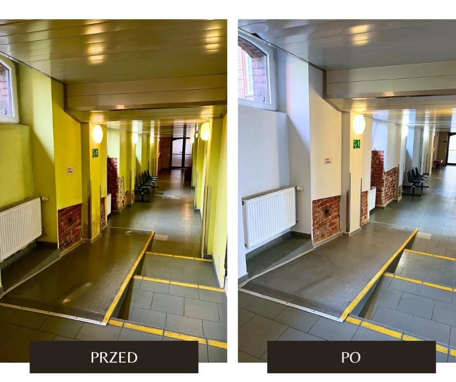 Szpital Miejski zmienia się dla gliwiczan – remont Zakładu Fizjoterapii zakończony