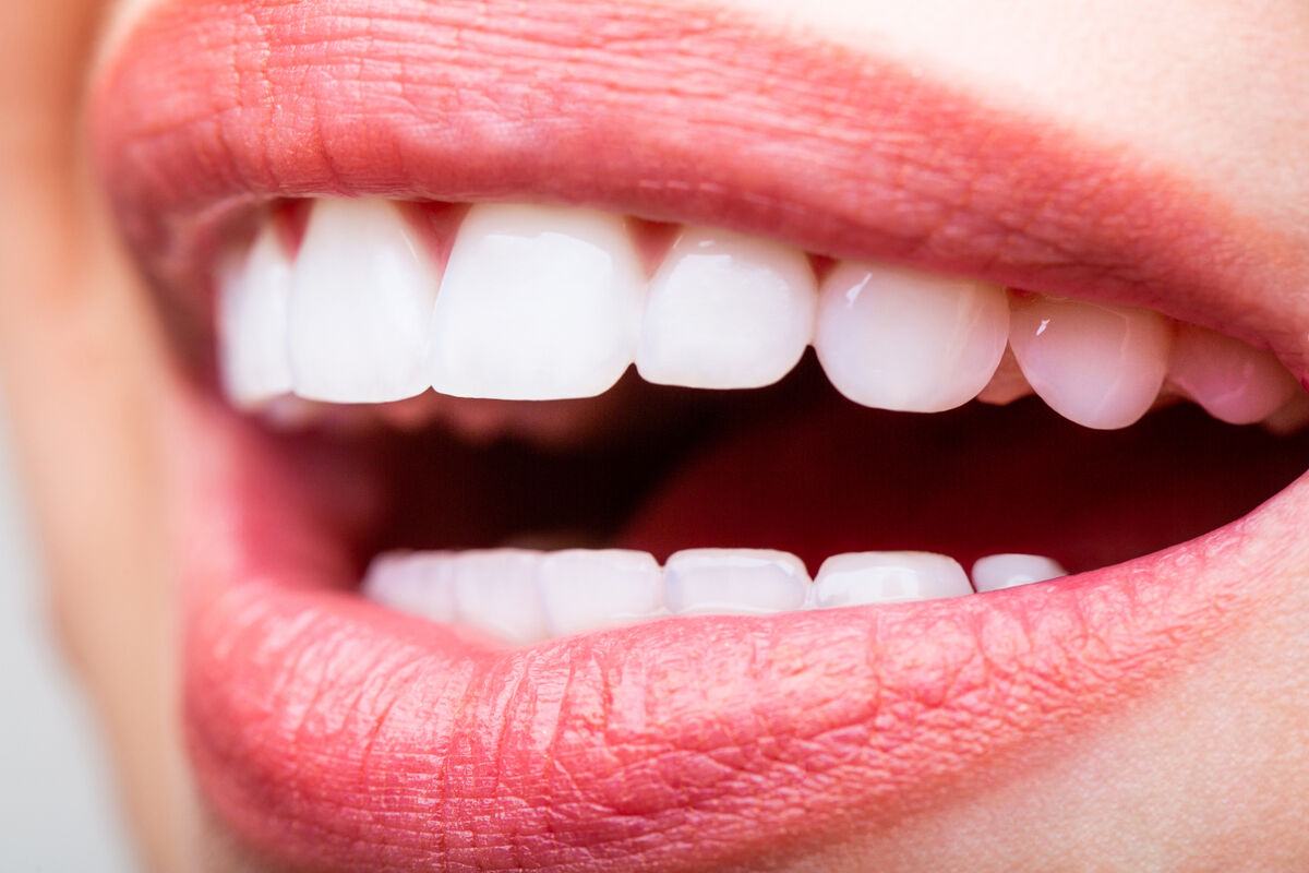 Ile lat wytrzymuje implant zęba?