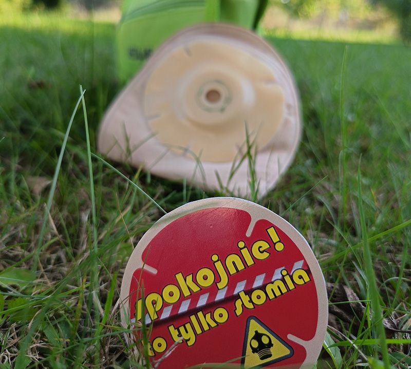 Stomia – Twoje życie po zabiegu wyłonienia