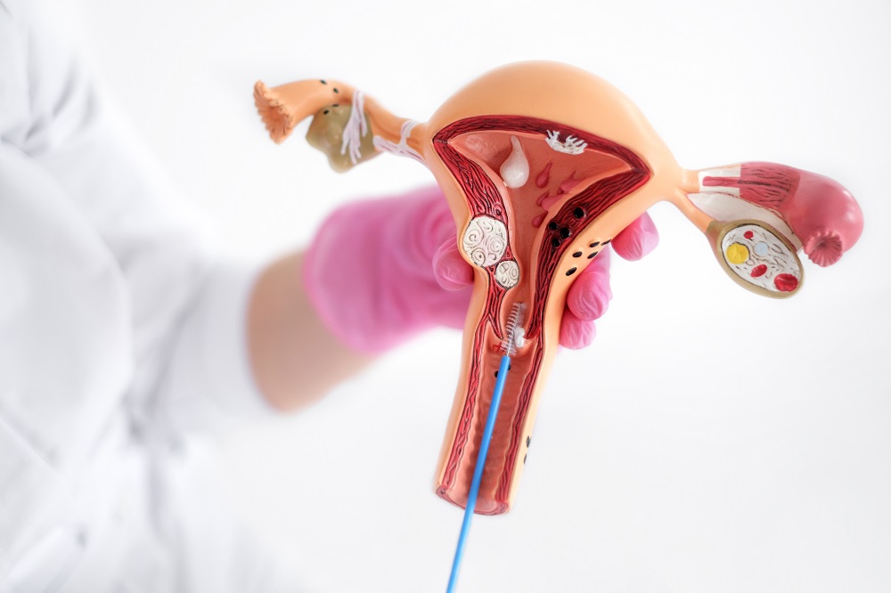 Gdzie boli zapalenie przydatków?