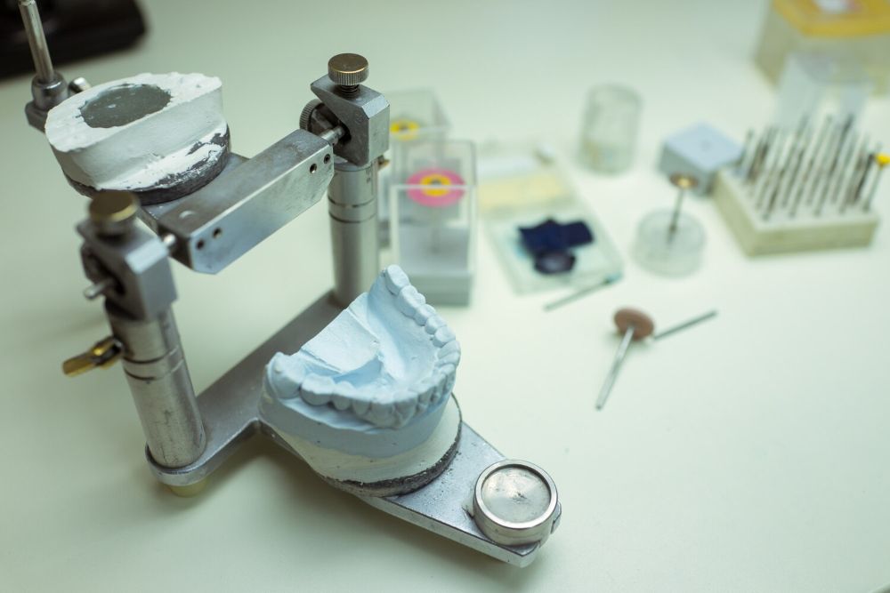 Implanty stomatologiczne od renomowanego dystrybutora: Bezpieczeństwo i gwarancja jakości