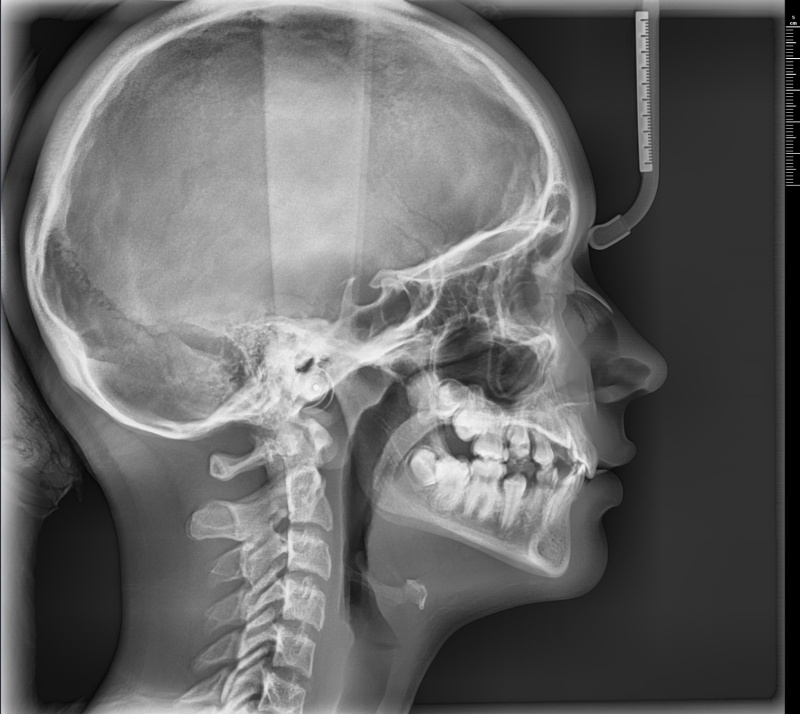 RTG stomatologiczne, CBCT od 100 zł Świętochłowice