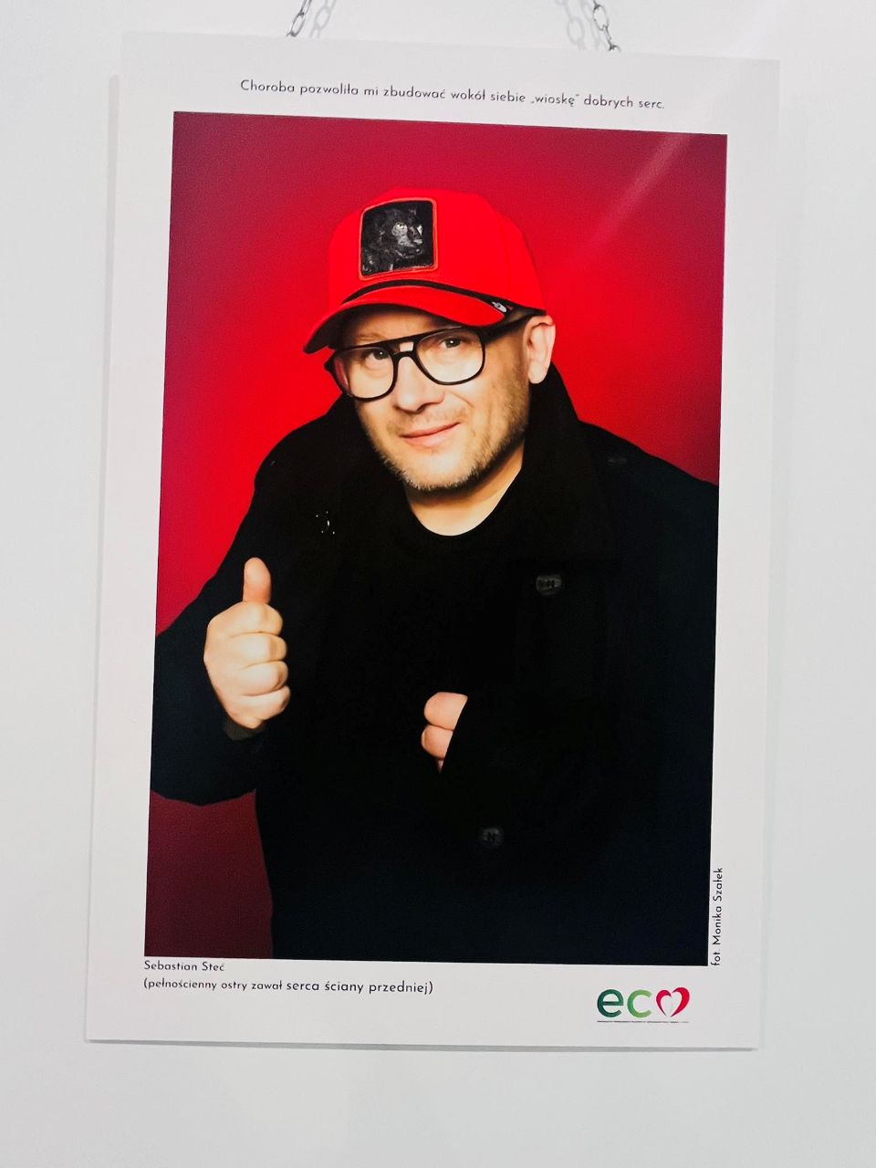 Sosnowiczanin twarzą w ogólnopolskiej wystawie „Zobacz moje serce"