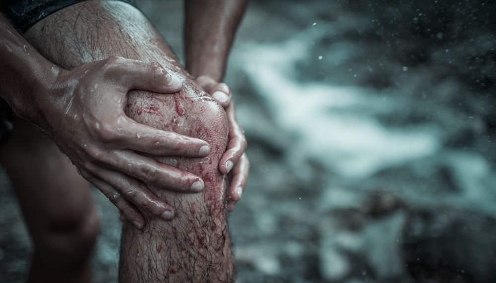 Kolano biegacza bez mitów: co działa, a co tylko traci twój czas