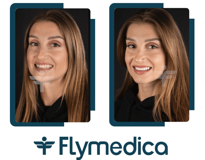 Kolor zębów - co na niego wpływa?