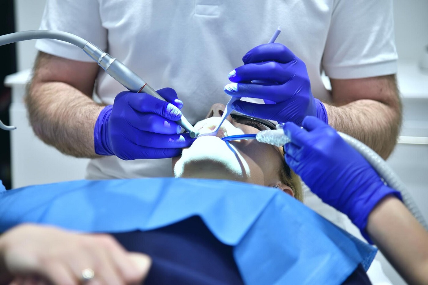 Zastosowanie koferdamu w endodoncji ? Dlaczego izolacja pola zabiegowego jest kluczowa?