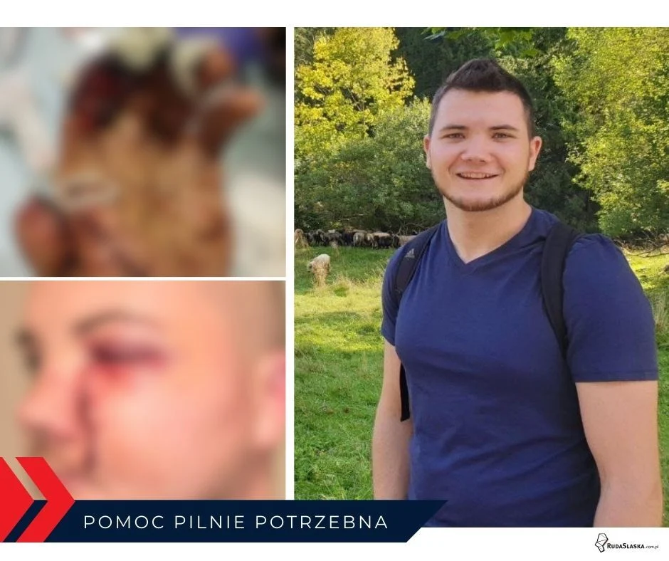 Dramatyczny finał sylwestrowej zabawy. 32-latek z Rudy Śląskiej walczy o powrót do zdrowia