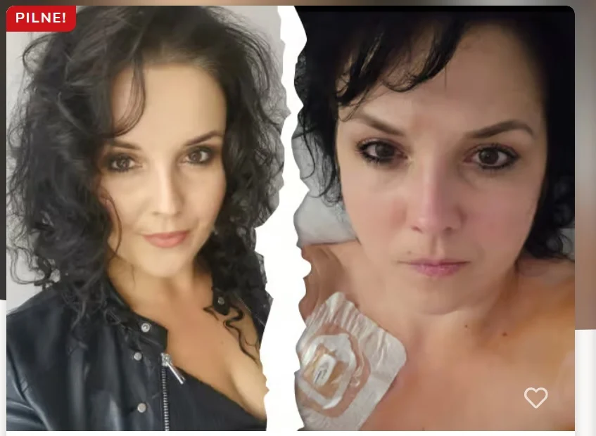 Agata z Orzesza walczy z nawrotem raka. Potrzebuje pomocy na leczenie i rehabilitację