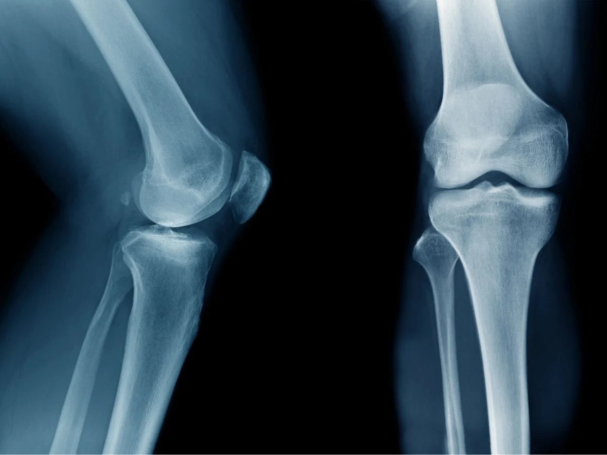 Ruda Śląska. Od 21 kwietnia RTG na Goduli będzie nieczynne. Badania tylko w Bielszowicach