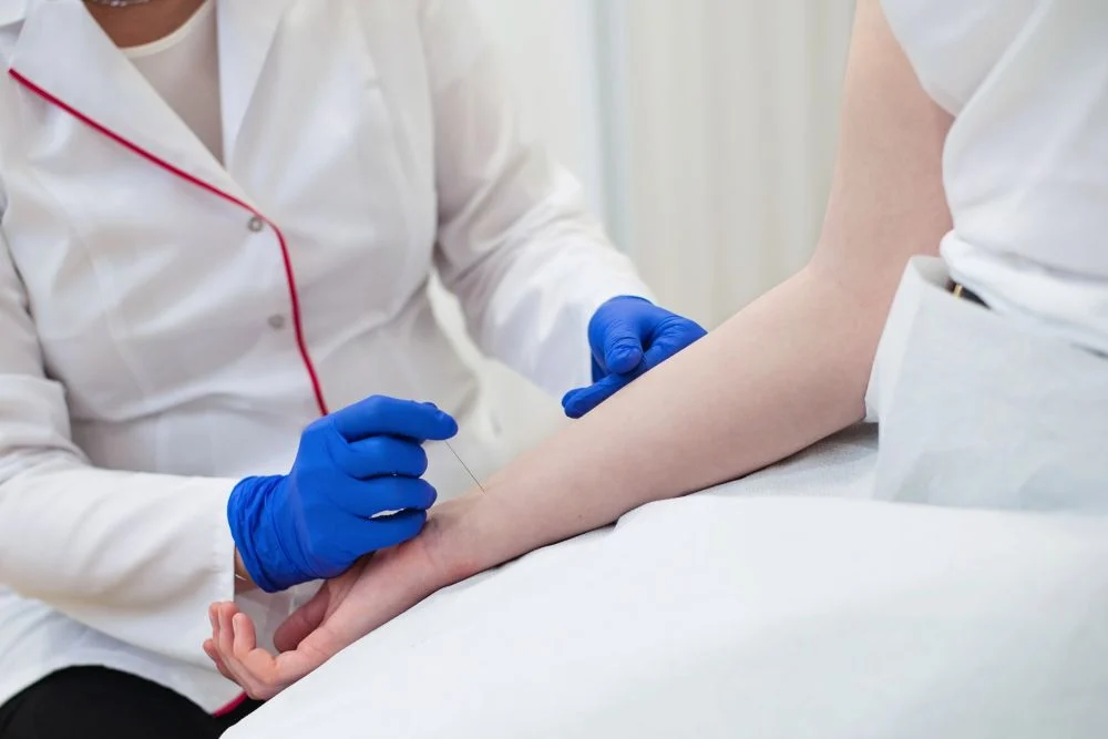 Akupunktura od 200 zł - naturalna terapia bólu, stresu i migren | Świętochłowice