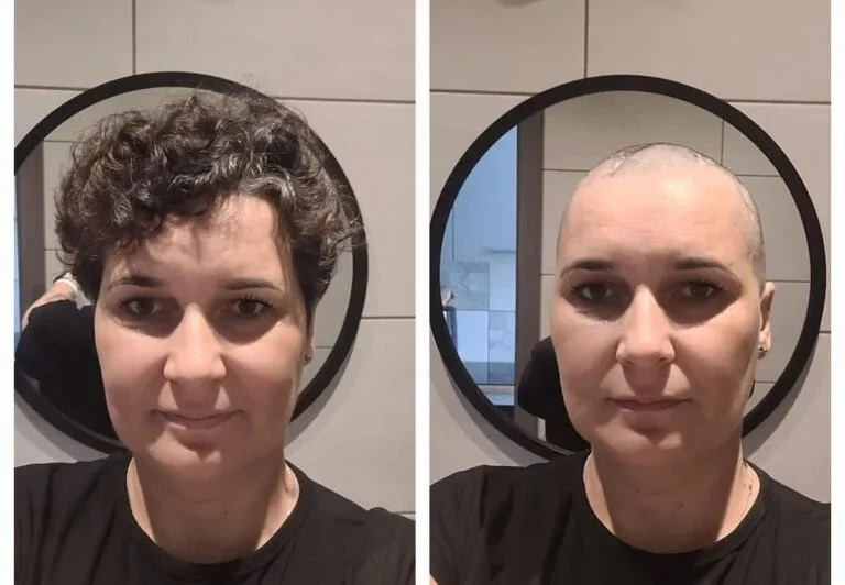 Pani Sylwia walczy z glejakiem. Każdy z nas może wesprzeć ją w walce z chorobą!